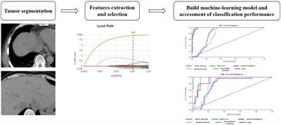 Radiomics Study for Differentiating Focal Hepatic Lesions Based on Unenhanced CT Images